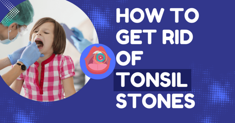 HOW TO GET RID OF TONSIL STONES