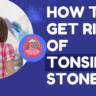 HOW TO GET RID OF TONSIL STONES