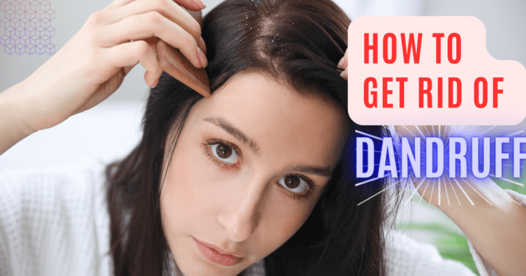 How to get rid of Dandruff